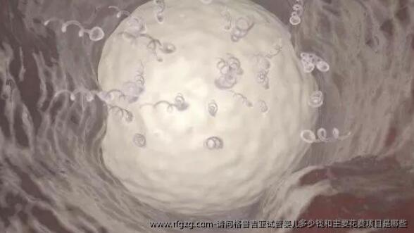 请问格鲁吉亚代孕多少钱和主要花费项目是哪些