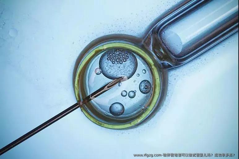 输卵管堵塞可以做代孕吗？成功率多高？