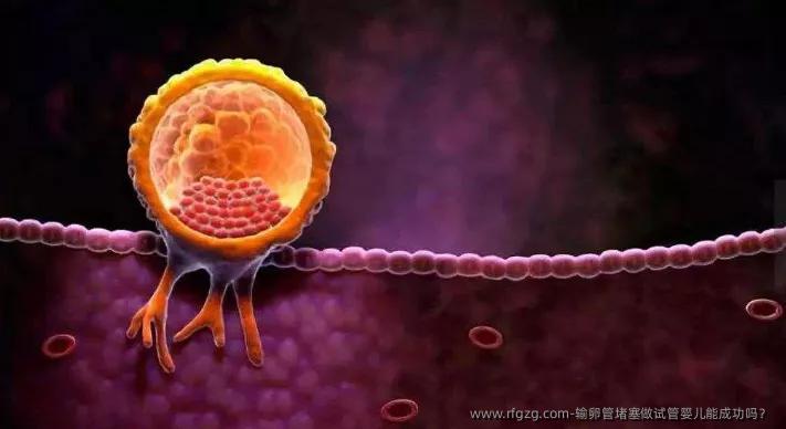 输卵管堵塞做代孕能成功吗？ 