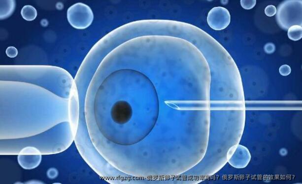 俄罗斯卵子试管成功率高吗？俄罗斯卵子试管的效果如何？